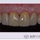 동의치과기공소 이미지