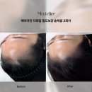 모뜰리에