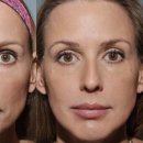 리즈라인의원 이미지