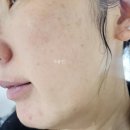 에이사 | 에스트라 에이사카365 리페어크림 사용후기
