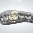 틀치과기공소 이미지