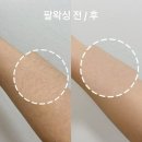 포에버왁싱&네일 | 경산왁싱 영대왁싱 포에버뷰티에서 받은 리얼 왁싱 후기