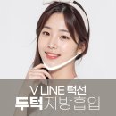 얼굴지방흡입 후기 이미지 변신 어때?