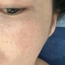 아름스킨케어 | 순천 왕지동 피부관리 아름온에스테틱 웨딩관리 받기 좋은 피부샵