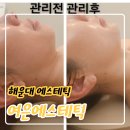 CU해운대경동2차점 | 해운대에스테틱 잘하는곳, 여은에스테틱 솔직 후기
