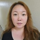 울쎄라 피프라임 300샷 효과 통증 강남역 피부과 추천 후기