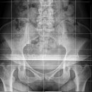 pelvic x-ray line drawing 과제입니다.^^ 이미지