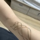 강남송도외과의원 | [롤리팝성형외과 의원] 강남 신사 문신제거 내돈내산 후기_3회차