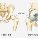 골반교정운동센터