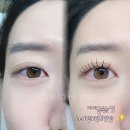 아이요(EYE YO) 네이버블로그