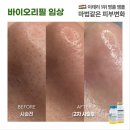 바이오에스테 | 예비신부 극찬 ! 모공 탄력 볼륨 한번에 <바이오리필> 울산 에스테무아