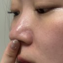 (유)큐리더 | [혜돈혜산] 블랙헤드 코팩 비교 후기｜원데이즈유 vs 몬스터팩토리 피지 제거 솔직 리뷰