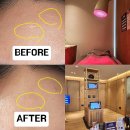 강남한의원 | 강남 새살침 한의원 내돈내산 후기 (효과 전후사진)