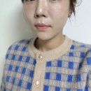 리슈빌딩 | 얼티밋리프팅프로제에서 예신관리하고 왔어요! 시그니처시술 올리슈 받고 온 무보정 후기