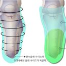 절단 장애인 다리의족 제작 기사 입니다. 이미지