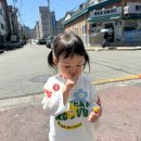 딸의 카페오레 반점 레이저 후기, 창원 더퍼스트피부과
