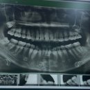 인천사랑니구강악안면외과치과의원 이미지