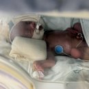 진통뼈사랑 | 임신 29주 조산, 조기진통에서 출산까지의 증상과 후기