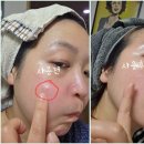 우리에스씨 | 병풀크림 더마에스씨 센텔라시카크림 민감성 트러블 피부 개선에 대한 경험담.