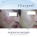 구산피부관리실 네이버블로그