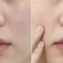 두드림나인 | 크림 발라도 건조할 때, 딱 2주 만에 스킨케어 밀림 없이 속건조 완벽히 잡는 루틴 (ft. 올영 찐템)