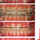 바른이김치과의원 이미지