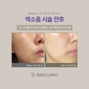 봉은사역 피부과 전문 병원 추천 BEST 6곳