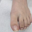 GS25진주장대점 | 진주 평거동 내성발톱 참지말고 후네일&amp;베어진주장대점 가보세요!