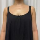 편한이웃약국 | 인천구월동피부과에서 팔뚝 지방분해주사 효과 통증 기록용 후기