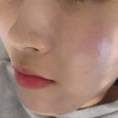 애자축산 | 서면에스테틱 한번 관리로도 눈에띄는 효과 세멘시트 피부피티