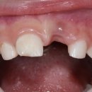 하이교정치과기공소 이미지