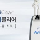 클리어레이저