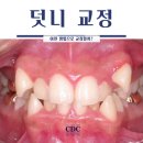 조재형치과의원 네이버블로그