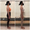 지움의원 | (대전용전동체형교정) 혹시.. 나도 척추측만일까? 체형교정은 지움바디기구필라테스와 함께해요!