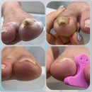 풋솔루션 이미지