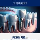 송탄이치과의원 네이버블로그