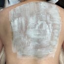 다은공영주차장 | 서울 봉천동 서울대입구 에스테틱 다은에서 오랜 숙원사업이었던 등드름흉터 박멸한 후기