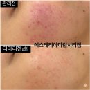 184 | 해운대피부관리 에스테티아 마린시티점 윤곽관리 후기