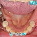 성현동-37 네이버블로그