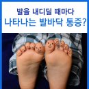 발 스트레칭,발 운동을 통한 발바닥 통증, 발뒤꿈치 통증 예방 이미지