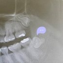 차앤백구강악안면외과치과의원 이미지