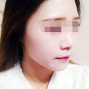 윤곽