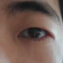 경산밝은안과 이미지