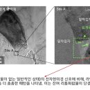 하이 전기박사