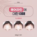 라인 | 헤어 라인 교정후기