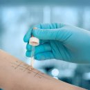 알레르기 이미지