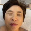 오룸스킨 이미지