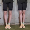 울산 오다리 교정 수술X, 깔창X, 운동만으로 교정가능한가요? (24회 실제 회원님 사례)