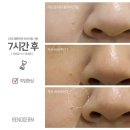 공업탑피부관리