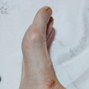 전일봉한의원 Daum카페